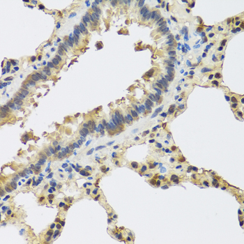 Immunohistochemistry - IL25 Polyclonal Antibody 