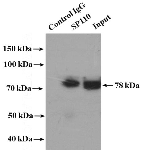 IP Result of anti-SP110 (IP:Catalog No:115523, 4ug; Detection:Catalog No:115523 1:800) with HeLa cells lysate 4000ug.