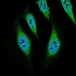Fig4: ICC staining CD68 (green) and Actin filaments (red) in Hela cells. The nuclear counter stain is DAPI (blue). Cells were fixed in paraformaldehyde, permeabilised with 0.25% Triton X100/PBS.