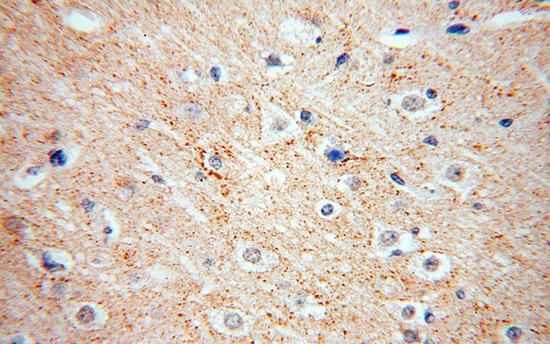 Immunohistochemical of paraffin-embedded human brain using Catalog No:114699(RIC8B antibody) at dilution of 1:100 (under 40x lens)