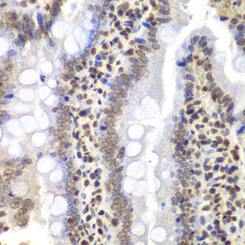 Immunohistochemistry - PSMC3 Polyclonal Antibody 