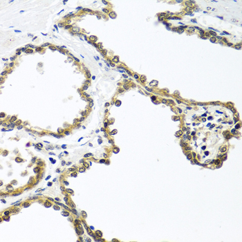 Immunohistochemistry - ARSF Polyclonal Antibody 