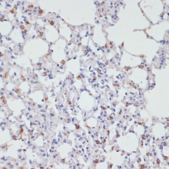 Immunohistochemistry - SFTPC Polyclonal Antibody 