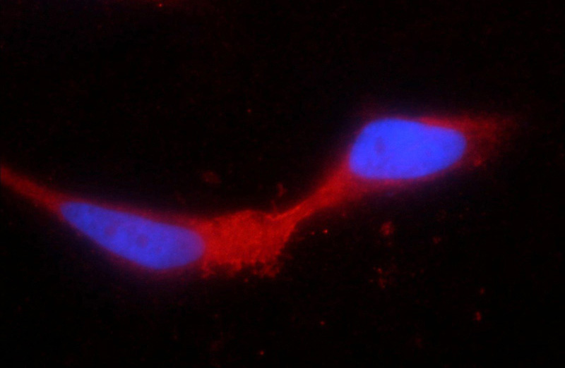 Immunofluorescent analysis of HEK-293 cells using Catalog No:116418(TRPV5 Antibody) at dilution of 1:25 and Rhodamine-Goat anti-Rabbit IgG