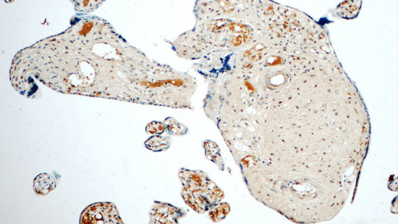 Immunohistochemistry of paraffin-embedded human placenta tissue slide using Catalog No:107409(LYN Antibody) at dilution of 1:50 (under 10x lens)