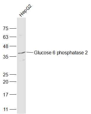 Fig1: Sample:; HepG2(Human) Cell Lysate at 30 ug; Primary: Anti-Glucose 6 phosphatase 2 at 1/1000 dilution; Secondary: IRDye800CW Goat Anti-Rabbit IgG at 1/20000 dilution; Predicted band size: 41 kD; Observed band size: 41 kD