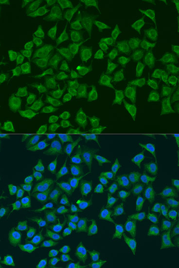 Immunofluorescence - NOS2 Polyclonal Antibody 