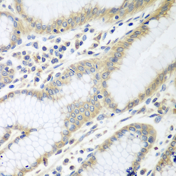 Immunohistochemistry - RPN2 Polyclonal Antibody 