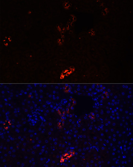 Immunofluorescence - AQP2 Polyclonal Antibody 