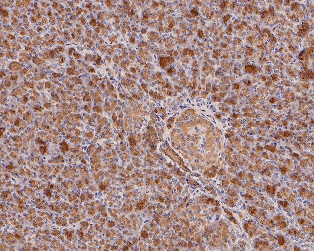 Fig3:; Immunohistochemical analysis of paraffin-embedded human pancreas tissue using anti-PRSS2 antibody. The section was pre-treated using heat mediated antigen retrieval with Tris-EDTA buffer (pH 8.0-8.4) for 20 minutes.The tissues were blocked in 5% BSA for 30 minutes at room temperature, washed with ddH; 2; O and PBS, and then probed with the primary antibody ( 1/800) for 30 minutes at room temperature. The detection was performed using an HRP conjugated compact polymer system. DAB was used as the chromogen. Tissues were counterstained with hematoxylin and mounted with DPX.