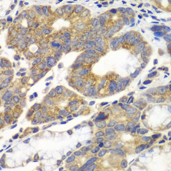 Immunohistochemistry - PFKM Polyclonal Antibody 