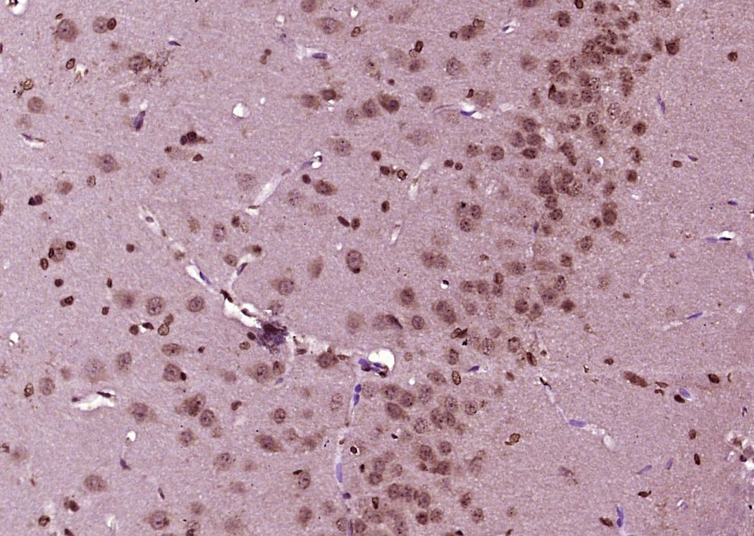 Fig2: Paraformaldehyde-fixed, paraffin embedded (Rat brain); Antigen retrieval by boiling in sodium citrate buffer (pH6.0) for 15min; Block endogenous peroxidase by 3% hydrogen peroxide for 20 minutes; Blocking buffer (normal goat serum) at 37℃ for 30min; Antibody incubation with (KIBRA) Polyclonal Antibody, Unconjugated at 1:400 overnight at 4℃, followed by operating according to SP Kit(Rabbit) (sp-0023) instructionsand DAB staining.