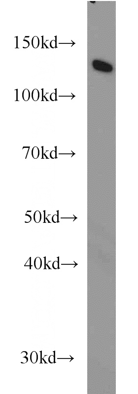 HeLa cells were subjected to SDS PAGE followed by western blot with Catalog No:107237(DDB1 antibody) at dilution of 1:1000