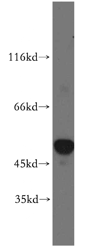 mouse pancreas tissue were subjected to SDS PAGE followed by western blot with Catalog No:115329(SLC25A23 antibody) at dilution of 1:1000