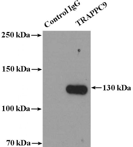 IP Result of anti-TRAPPC9,NIBP (IP:Catalog No:116346, 4ug; Detection:Catalog No:116346 1:500) with mouse brain tissue lysate 3600ug.
