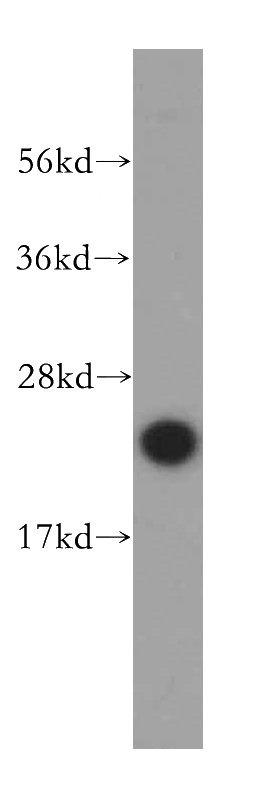 MDA-MB-453s cells were subjected to SDS PAGE followed by western blot with Catalog No:116535(UBE2S antibody) at dilution of 1:500