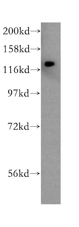 human brain tissue were subjected to SDS PAGE followed by western blot with Catalog No:109932(DHX36 antibody) at dilution of 1:800