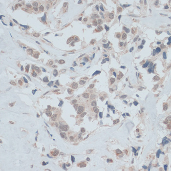 Immunohistochemistry - ZNF446 Polyclonal Antibody 
