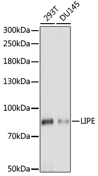 Western blot - LIPE Polyclonal Antibody 