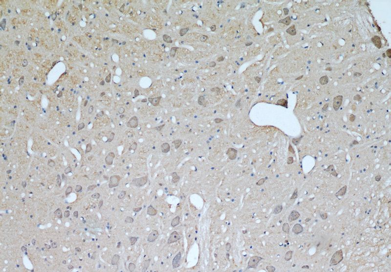 Immunohistochemical of paraffin-embedded rat brain using Catalog No:116545(UCP1 antibody) at dilution of 1:50 (under 10x lens)