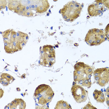 Immunohistochemistry - TUBB8 Polyclonal Antibody 