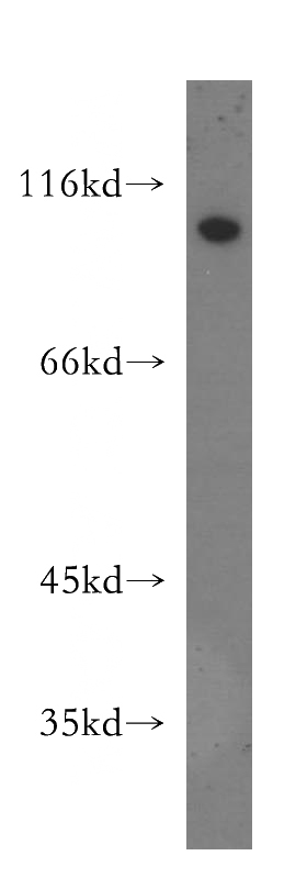 HeLa cells were subjected to SDS PAGE followed by western blot with Catalog No:113373(NUP107 antibody) at dilution of 1:1000