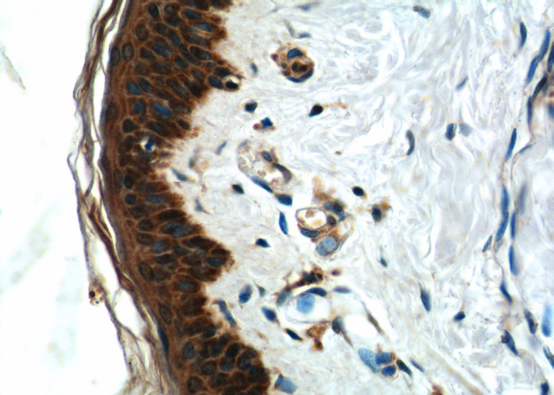 Immunohistochemistry of paraffin-embedded human skin tissue slide using Catalog No:107694(ACSF2 Antibody) at dilution of 1:50 (under 40x lens)