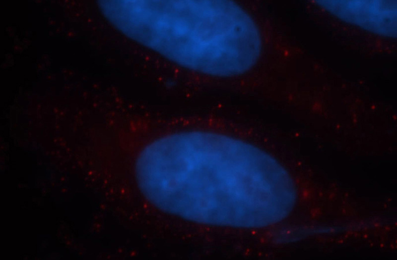 Immunofluorescent analysis of HepG2 cells, using TMEM27 antibody Catalog No:116182 at 1:25 dilution and Rhodamine-labeled goat anti-rabbit IgG (red). Blue pseudocolor = DAPI (fluorescent DNA dye).