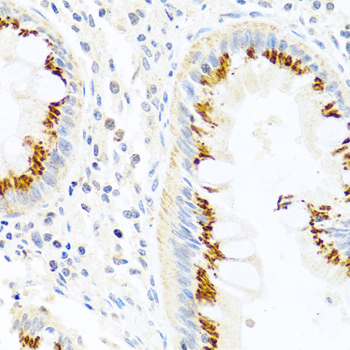 Immunohistochemistry - FAM3B Polyclonal Antibody 