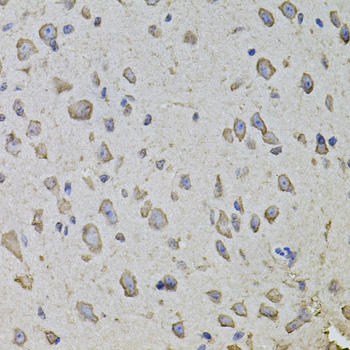 Immunohistochemistry - ARHGEF3 Polyclonal Antibody 