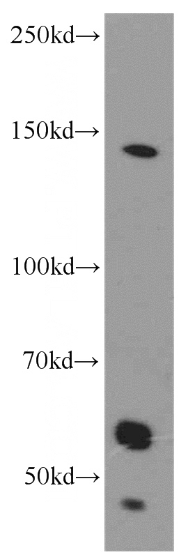 SH-SY5Y cells were subjected to SDS PAGE followed by western blot with Catalog No:109171(CDON antibody) at dilution of 1:1000