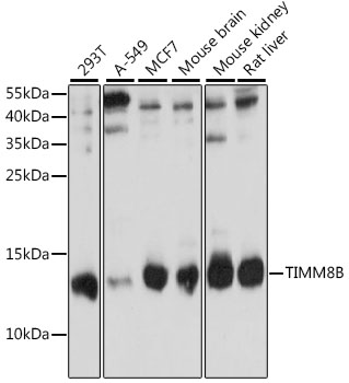 Western blot - TIMM8B Polyclonal Antibody 