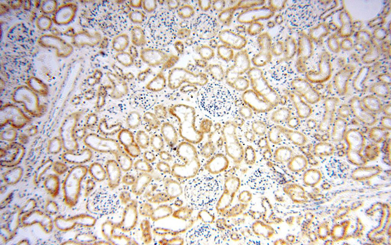 Immunohistochemical of paraffin-embedded human kidney using Catalog No:115063(SAPS3 antibody) at dilution of 1:100 (under 10x lens)