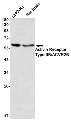 Western blot detection of Activin Receptor Type IIB/ACVR2B in CHO-K1,mouse Brain using Activin Receptor Type IIB/ACVR2B Rabbit mAb(1:1000 diluted)