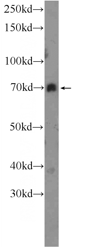 mouse kidney tissue were subjected to SDS PAGE followed by western blot with Catalog No:110620(FERMT1 Antibody) at dilution of 1:300