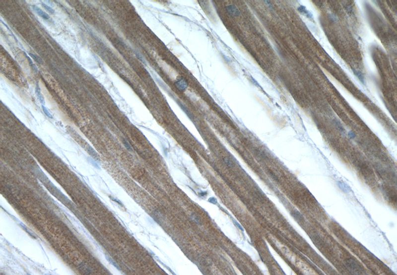 Immunohistochemistry of paraffin-embedded human heart tissue slide using Catalog No:112285(LMOD3 Antibody) at dilution of 1:50 (under 40x lens)