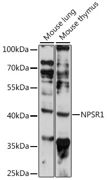 Western blot - NPSR1 Polyclonal Antibody 