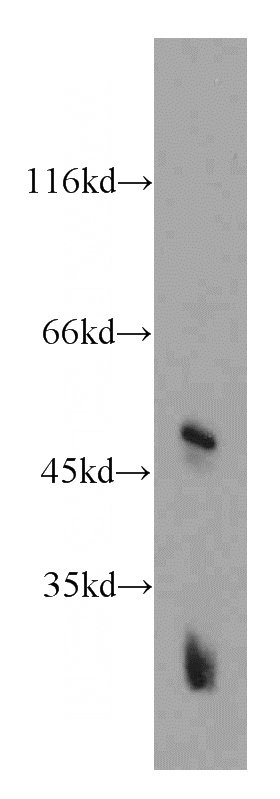 mouse brain tissue were subjected to SDS PAGE followed by western blot with Catalog No:111111(GPR137 antibody) at dilution of 1:300