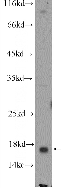 PC-3 cells were subjected to SDS PAGE followed by western blot with Catalog No:108777(C6orf130 Antibody) at dilution of 1:300