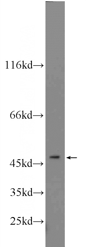 mouse pancreas tissue were subjected to SDS PAGE followed by western blot with Catalog No:117153(ZNF271 antibody) at dilution of 1:1000