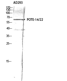 Fig1:; Western Blot analysis of AD293 using POTE-14/22 Polyclonal Antibody diluted at 1: 2000