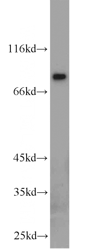 mouse liver tissue were subjected to SDS PAGE followed by western blot with Catalog No:107828(AGGF1 antibody) at dilution of 1:1000