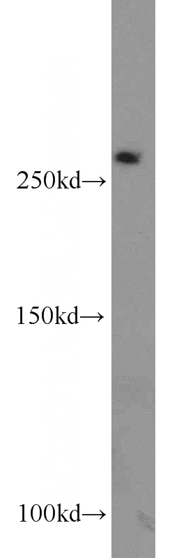 mouse liver tissue were subjected to SDS PAGE followed by western blot with Catalog No:112583(MED12L antibody) at dilution of 1:500
