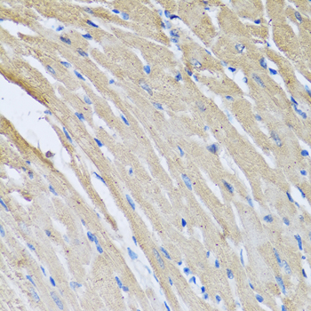Immunohistochemistry - CRHBP Polyclonal Antibody 