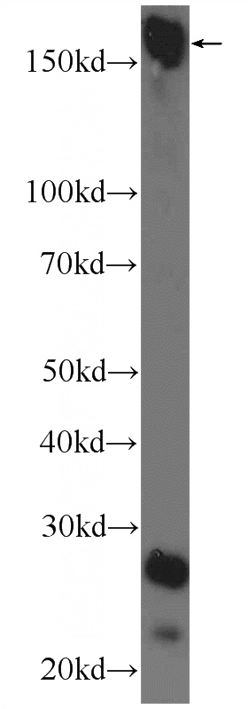 mouse brain tissue were subjected to SDS PAGE followed by western blot with Catalog No:116564(UHRF1BP1L Antibody) at dilution of 1:1500