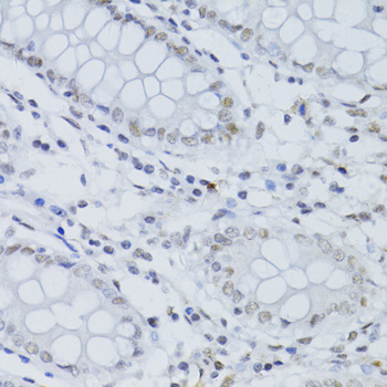 Immunohistochemistry - SNRNP70 Polyclonal Antibody 