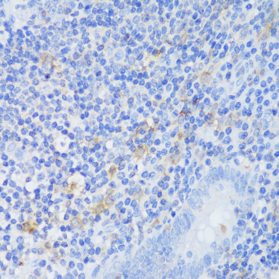 Immunohistochemistry - EFHD2 Polyclonal Antibody 
