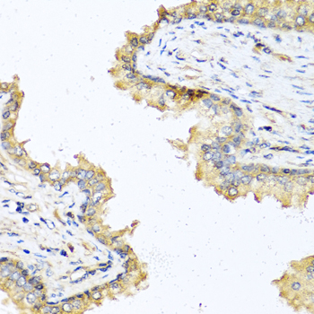 Immunohistochemistry - DEFB121 Polyclonal Antibody 