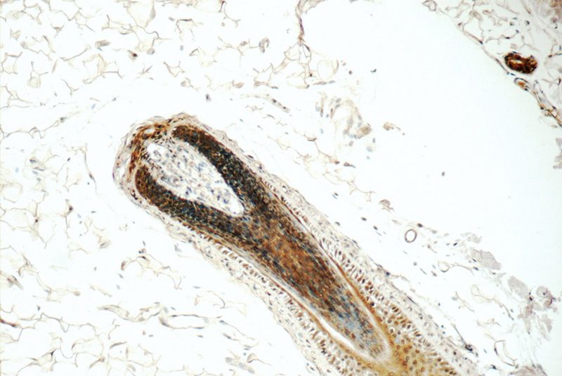 Immunohistochemistry of paraffin-embedded human skin tissue slide using Catalog No:113911(PINX1 Antibody) at dilution of 1:50 (under 10x lens)