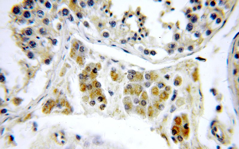 Immunohistochemical of paraffin-embedded human testis using Catalog No:113894(PIGM antibody) at dilution of 1:100 (under 40x lens)
